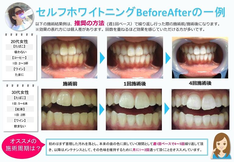 ビフォーアフター